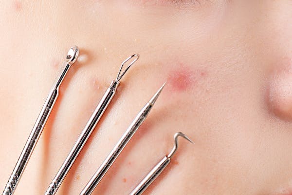 Tratamento de Estrias